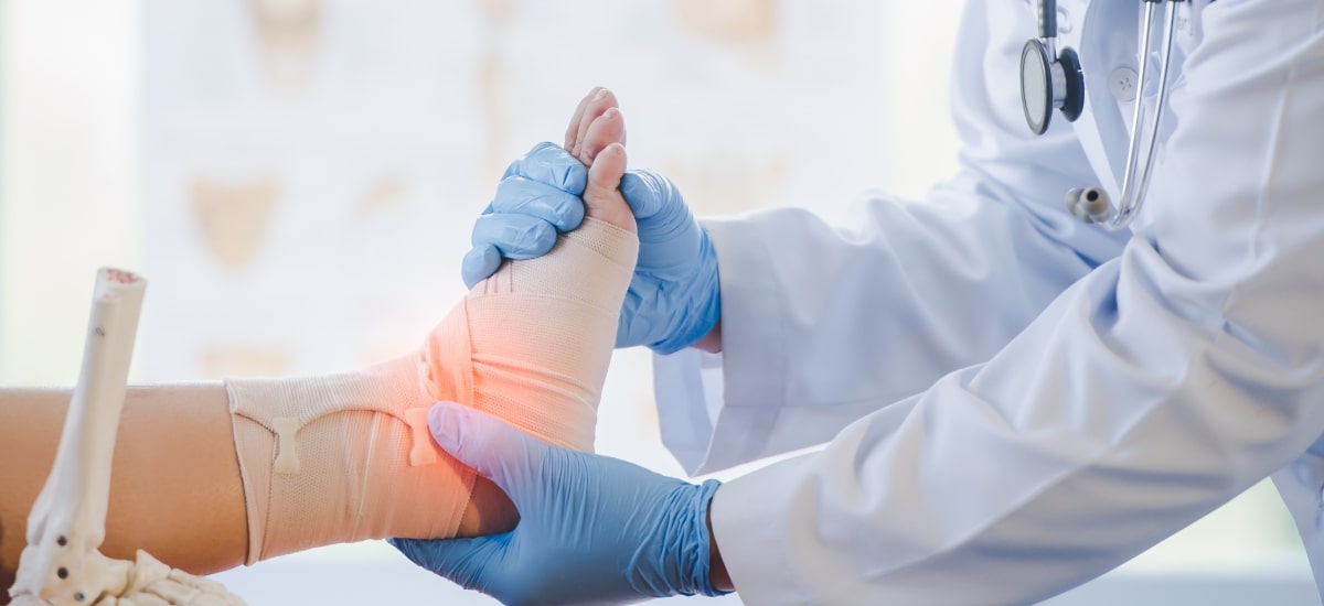 Cannabis para lesões